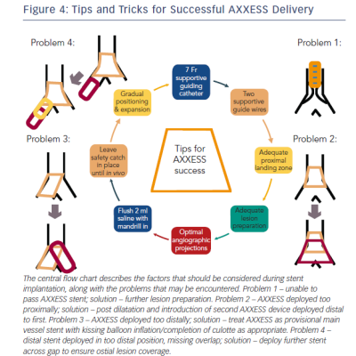 Figure 4 Tips and Tricks for Successful AXXESS Delivery