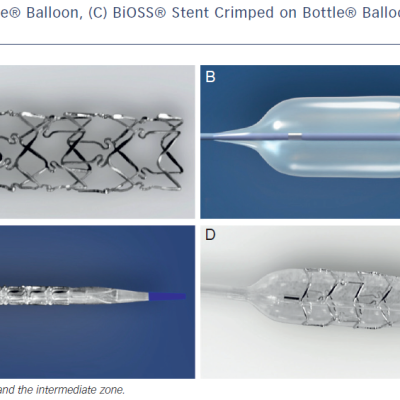 A-Stent-B-Bottle-C-Stent-Crimped-on-Bottle-D-Stent-on-Inflated
