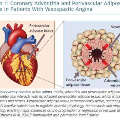 Coronary Adventitia And Perivascular Adipose Tissue In Patients With Vasospastic Angina