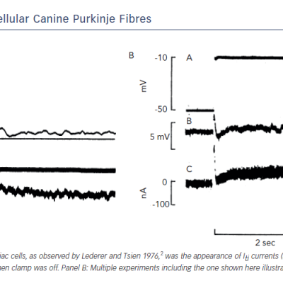 Figure 1 Evidence of Iti in Multicellular Canine Purkinje Fibres