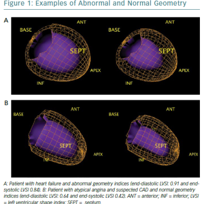 Examples Of Abnormal And Normal Geometry