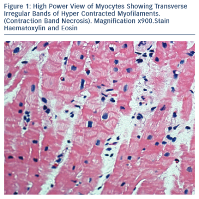 High Power View of Myocytes