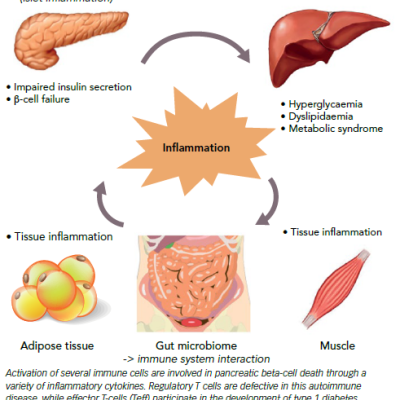 Inflammatory Mediators In Type 1 Diabetes