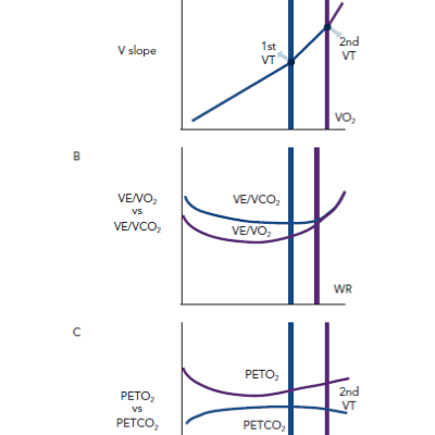 Figure 1 Non-invasive Identification of the 1st VT and 2nd VT by CPET Evaluation