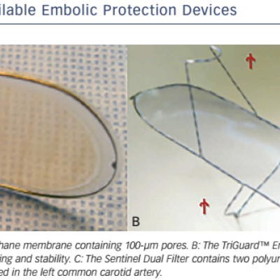 Figure 1 Overview of Commercially Available Embolic Protection Devices