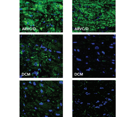 Figure 1 Phospolamban Protein Expression and Localisation