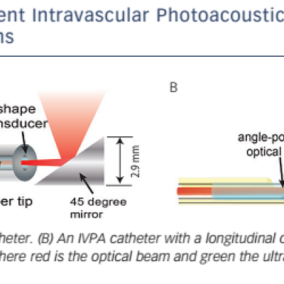 Figure 2 Different Intravascular Photoacoustic IVPA Catheter Designs