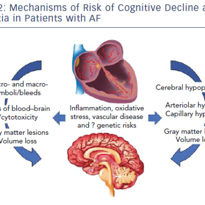 Mechanisms Of Risk Of Cognitive Decline And Dementia In Patients With AF