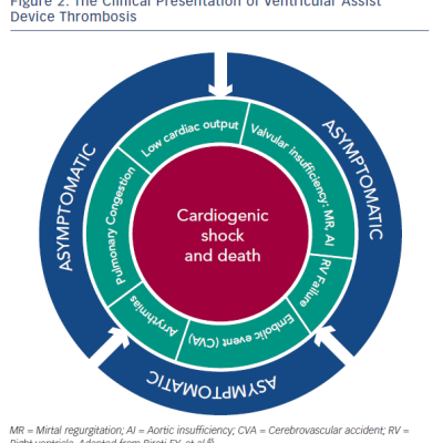 Figure 2 The Clinical Presentation of Ventricular Assist Device Thrombosis