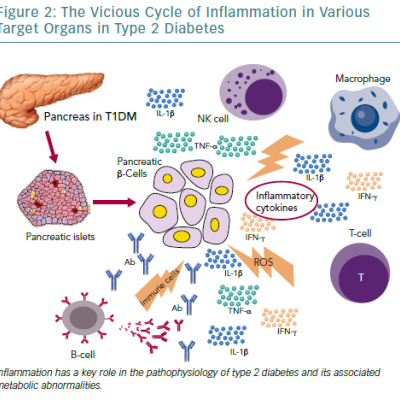 The Vicious Cycle Of Inflammation In Various Target Organs In Type 2 Diabetes