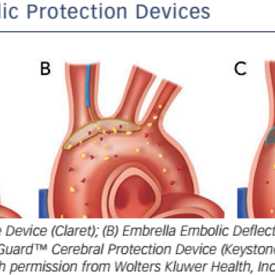 Figure 3 Embolic Protection Devices