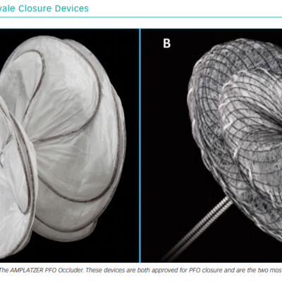 Patent Foramen Ovale Closure Devices