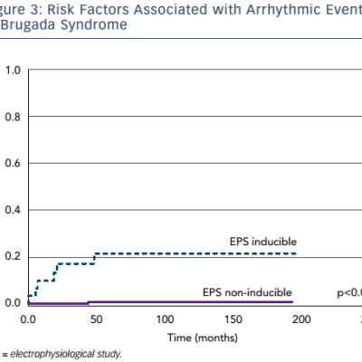 Risk Factors Associated with Arrhythmic Events in Brugada Syndrome
