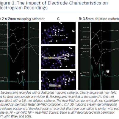 The Impact Of Electrode Characteristics On Electrogram Recordings