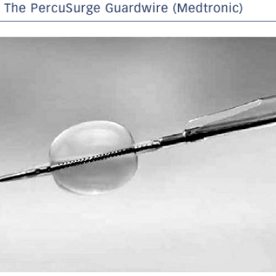 Figure 3 The PercuSurge Guardwire Medtronic