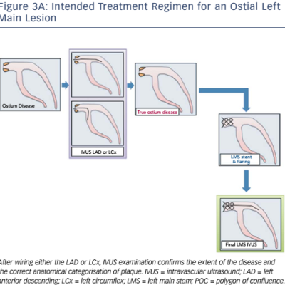 Figure 3A Intended Treatment Regimen for an Ostial Left Main Lesion