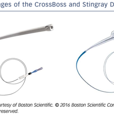 Figure 5 Images of the CrossBoss and Stingray Devices
