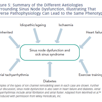 Figure 5 Summary of the Different Aetiologies Surrounding Sinus Node Dysfunction Illustrating That Diverse Pathophysiology Can Lead to the Same Phenotype