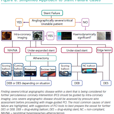 Simplified Approach to Stent Failure Cases