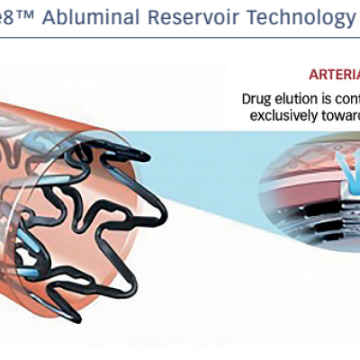 Figure 1 Cre8™ Abluminal Reservoir Technology