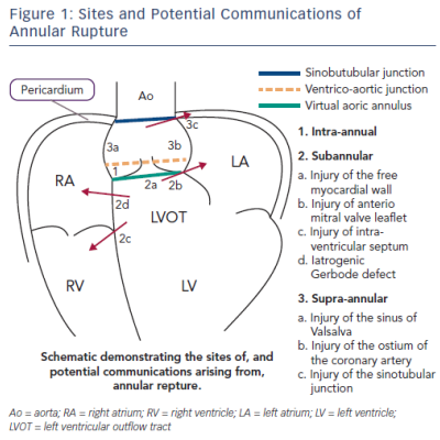 Figure1-sites-Potential