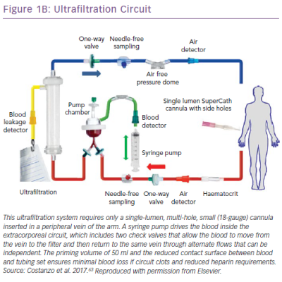 Ultrafiltration Circuit