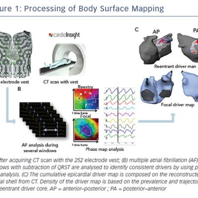Figure 1 Processing of Body Surface Mapping
