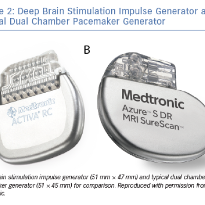 Deep Brain Stimulation Impulse Generator and Typical Dual Chamber Pacemaker Generator