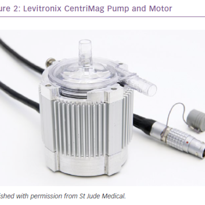 Levitronix CentriMag Pump and Motor