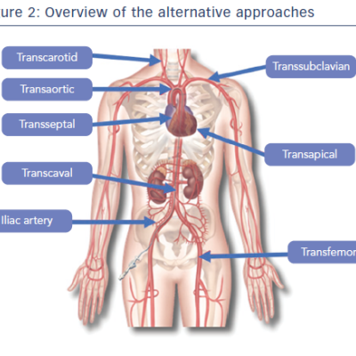 Figure 2 Overview of the alternative approaches