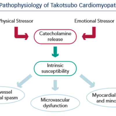 Pathophysiology of Takotsubo Cardiomyopathy