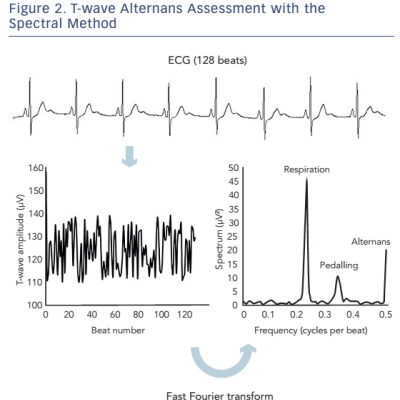 Figure 2. T-wave Alternans Assessment with the Spectral Method