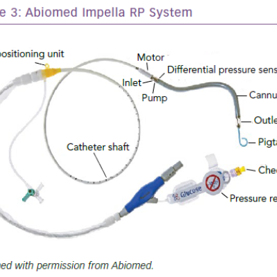 Abiomed Impella RP System