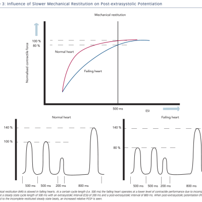 Figure 3 Influence of Slower Mechanical Restitution on Post-extrasystolic Potentiation