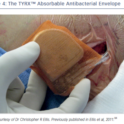 Figure 4 The TYRX™ Absorbable Antibacterial Envelope