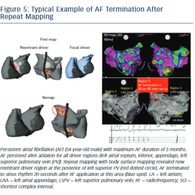 Figure 5 Typical Example of AF Termination After Repeat Mapping