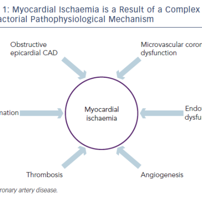 Figure 1 Myocardial Ischaemia is a Result of a Complex Multifactorial Pathophysiological Mechanism