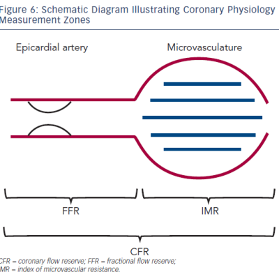 Figure 6 Schematic Diagram Illustrating Coronary Physiology Measurement Zones