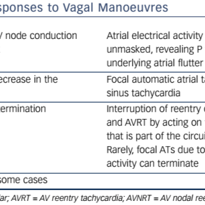 Responses to Vagal Manoeuvers