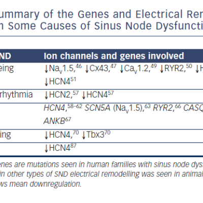 Table 1 Summary of the Genes and Electrical Remodelling Involved in Some Causes of Sinus Node Dysfunction