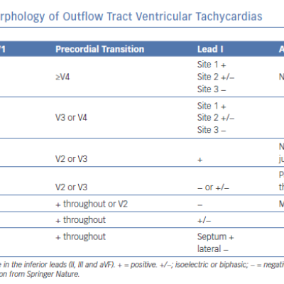 Electrocardiographic Morphology of Outflow Tract Ventricular Tachycardias