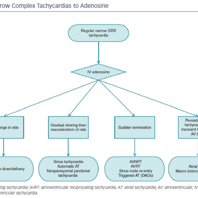 Figure 3 Responses of Narrow Complex Tachycardias to Adenosine