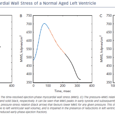 Figure 4 Time-Resolved Myocardial Wall Stress of a Normal Aged Left Ventricle