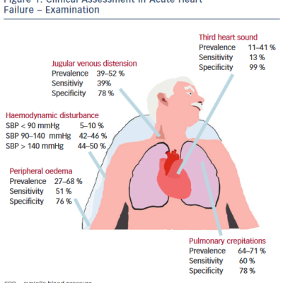 Clinical Assessment in Acute Heart Failure Examination