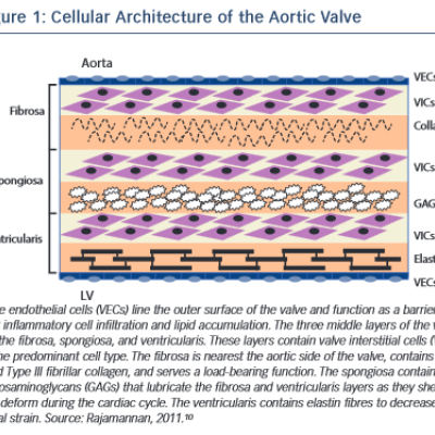 Cellular Architecture of the Aortic Valve