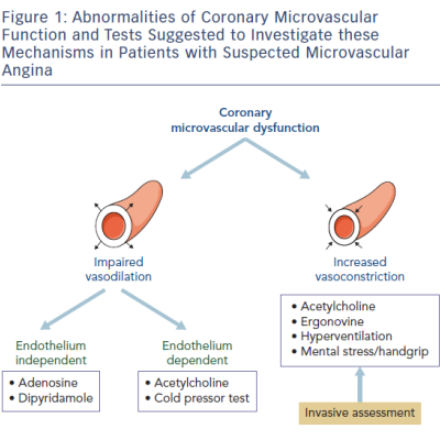 Figure 1 Abnormalities of Coronary Microvascular Function and Tests Suggested to Investigate these Mechanisms in Patients with Suspected Microvascular Angina