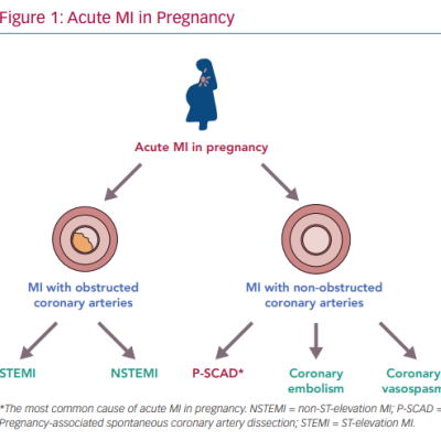 Acute MI in Pregnancy