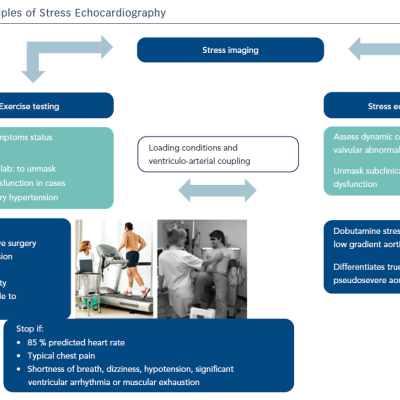 Figure 1 Basic Principles of Stress Echocardiography