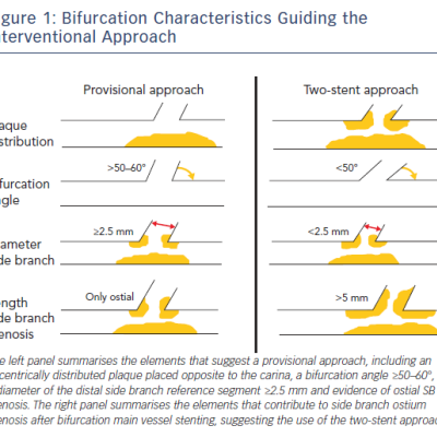 Bifurcation Characteristics Guiding the Interventional Approach