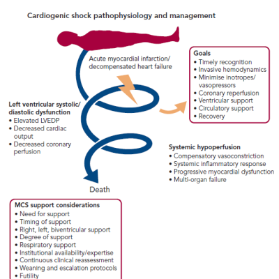 Figure 1 Cardiogenic Shock Pathophysiology and Management Considerations